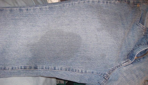 Как удалить не совсем свежее, жирное пятно джинс