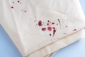 Как убрать пятна крови с белой одежды?