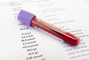 Риск возникновения страшных болезней покажет простой анализ крови