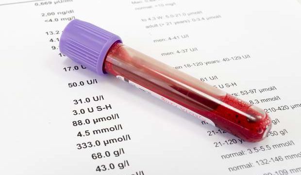 Риск возникновения страшных болезней покажет простой анализ крови